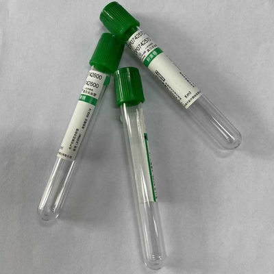 Sang courant d'essais de Clinicalbiochemistry rassemblant le dessus de vert de tube