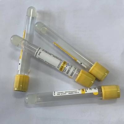 couverture principale jaune du vide 5ml de sang de tube jetable médical de collection